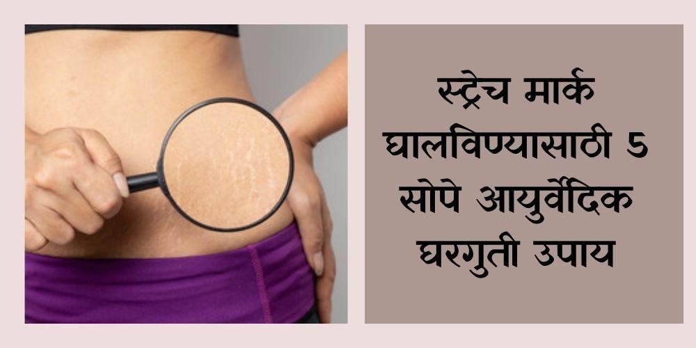 easy-ayurvedic-home-remedies-to-remove-stretch-marks
