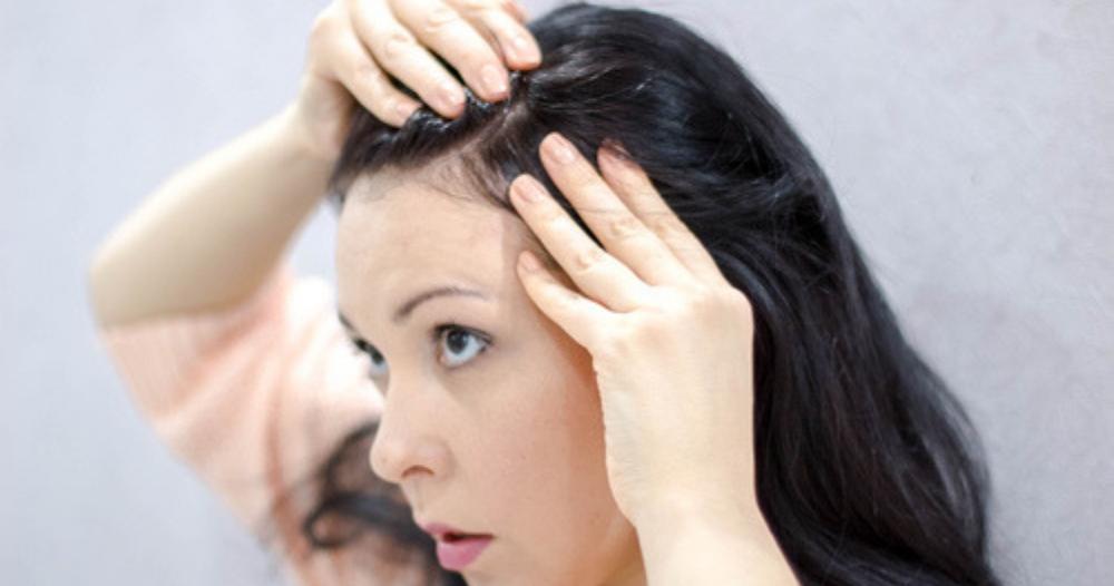 पांढरे केस काळे करण्यासाठी करा हे  ‘5’ सोपे आणि नैसर्गिक उपचार