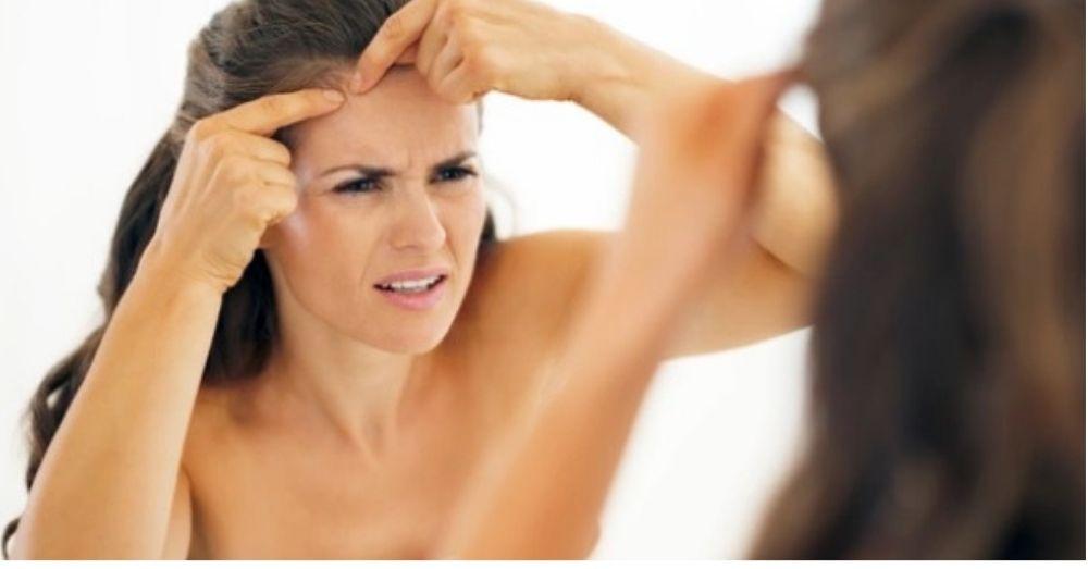 Adult Acne बद्दल तुम्हाला माहीत असायलाच हवेत ‘हे’ 6 Facts!