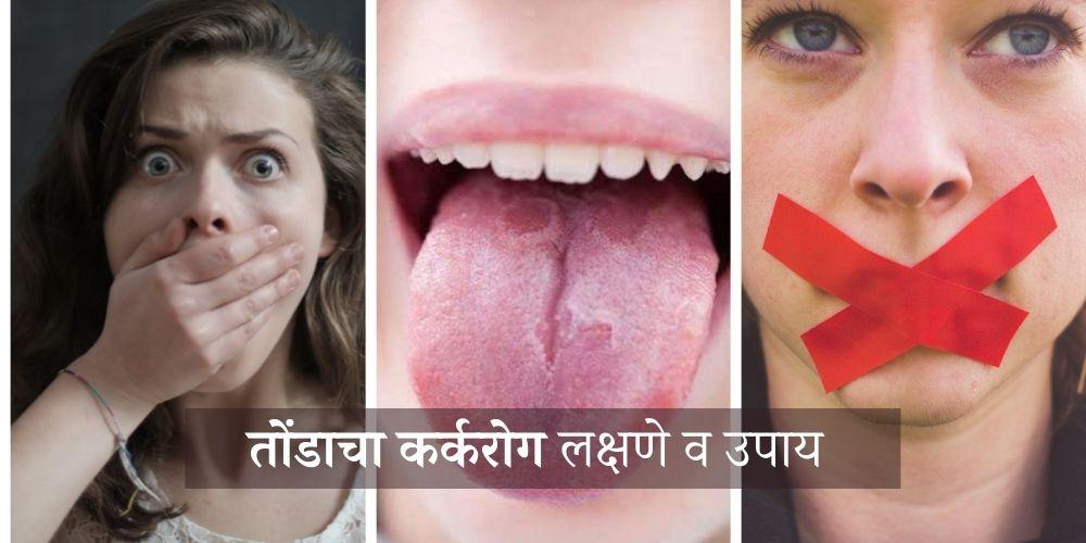 Mouth Cancer Symptoms In Marathi