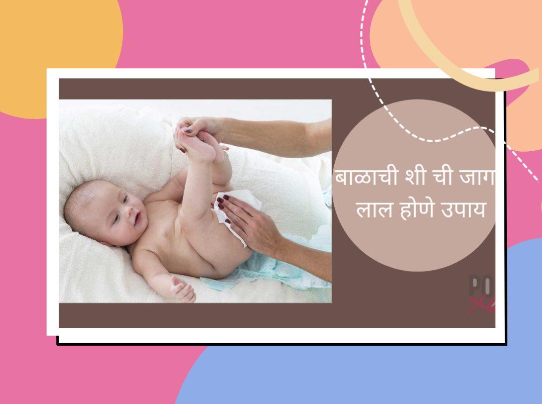 Babies Diaper Rash Home Remedies In Marathi