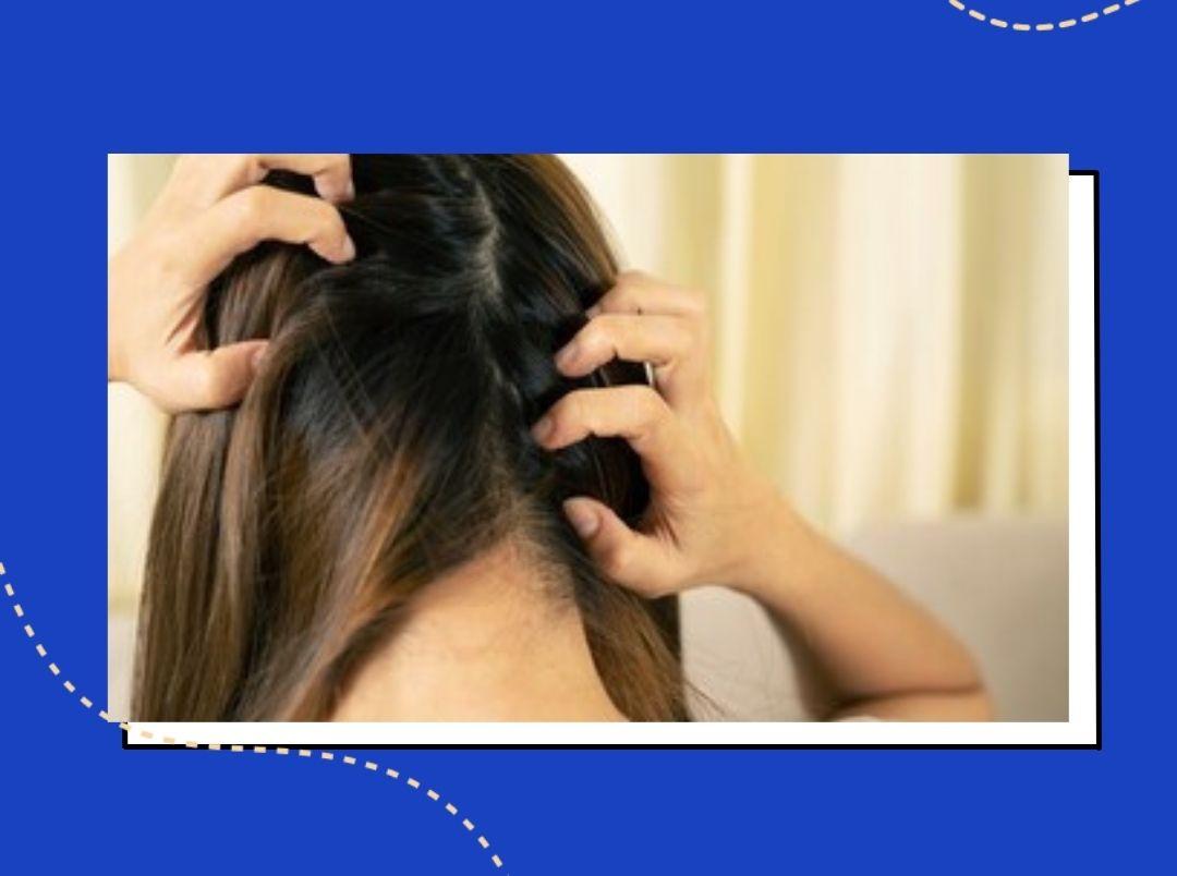 home-remedies-for-itchy-scalp-in-monsoon-in-marathi